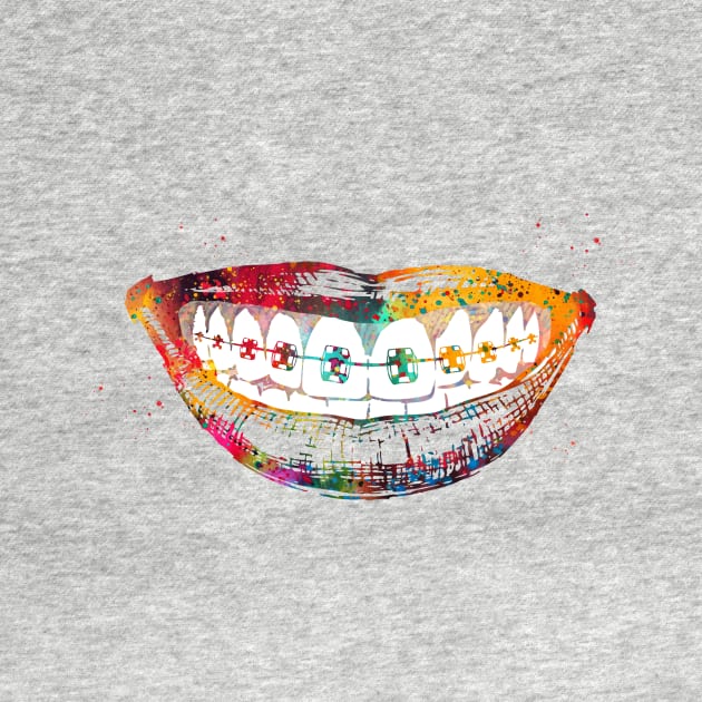 Teeth braces by erzebeth